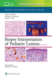 Biopsy Interpretation Of Pediatric Lesio