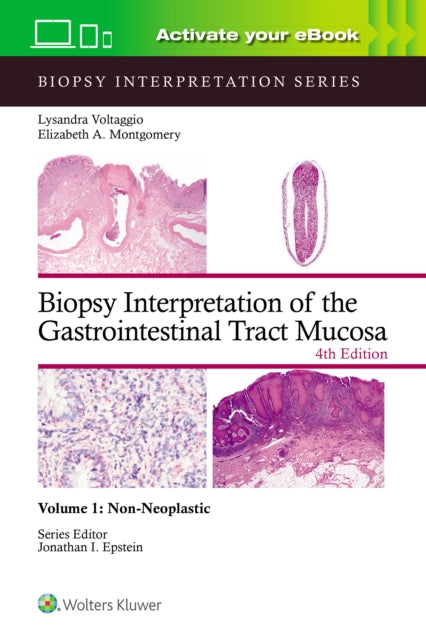Biopsy Interpretation Of The Gastrointes By Voltaggio, Lysandra,