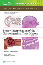 Biopsy Interpretation Of The Gastrointes