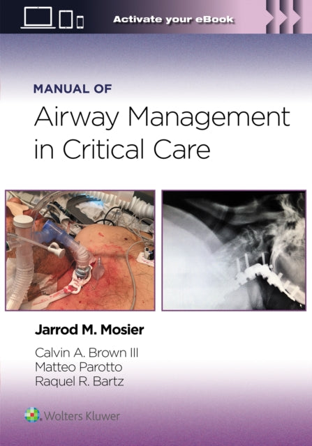 Manual Of Airway Management In Critical