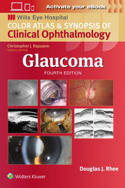 Glaucoma 4e