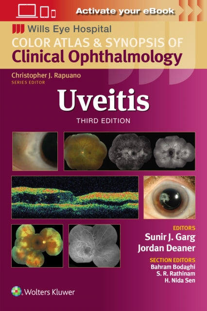 Uveitis 3e