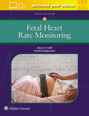 Fetal Heart Rate Monitoring By Alison Cahill