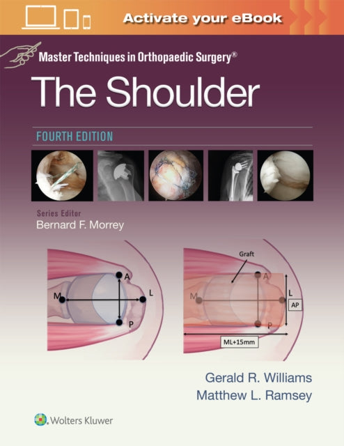Master Techniques In Orthopaedic Surger