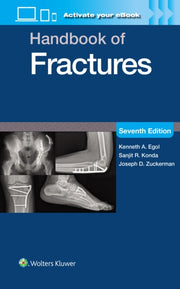 Handbook Of Fractures Print Ebook With M By Egol, Kenneth, A.