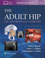 Adult Hip Hip Arthroplasty Surgery Print By Beaule, Paul