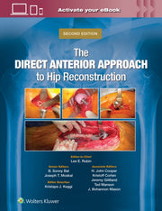Direct Anterior Approach To Hip Reconstr