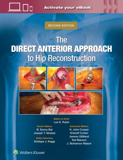 Direct Anterior Approach To Hip Reconstr