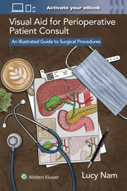 Visual Aid For Perioperative Patient Co