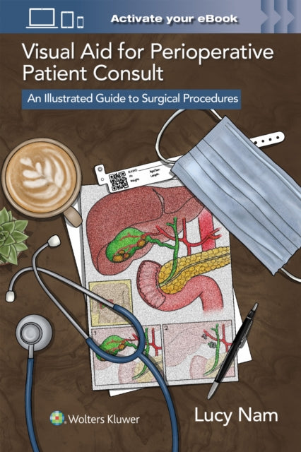 Visual Aid For Perioperative Patient Co