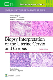 Biopsy Interpretation Of The Uterine Cer By Malpica, Anais,