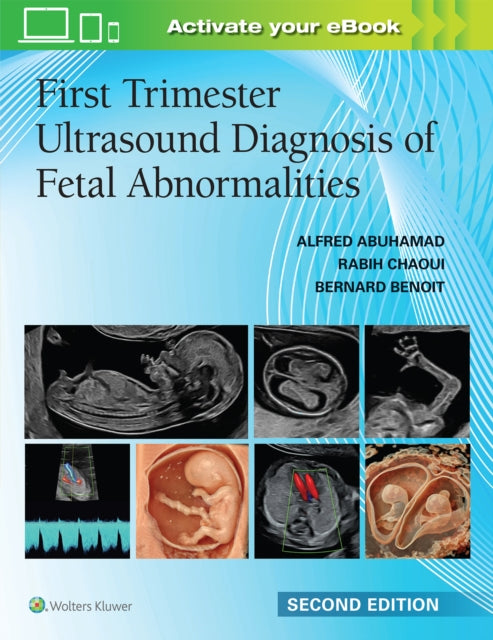 First Trimester Ultrasound Diagnosis Of By Abuhamad, Alfred, Z.