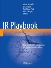 Ir Playbook