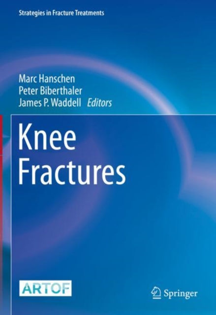 Knee Fractures By Hanschen, Marc