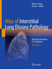 Atlas Of Interstitial Lung Disease Patho By Churg, Andrew