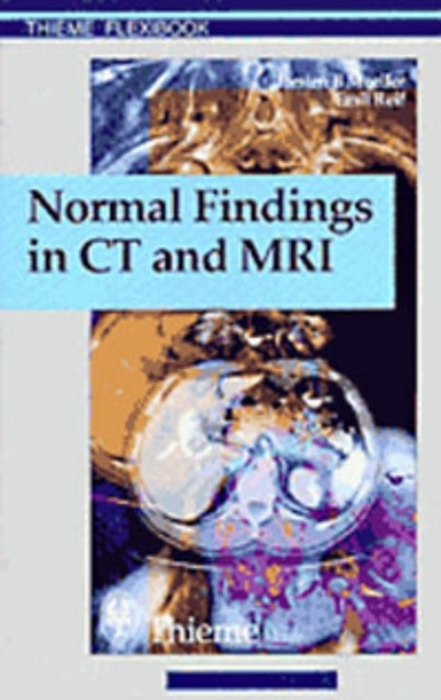 Normal Findings In Ct And Mri A1