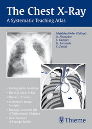 Chest Xray