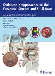 Endoscopic Approaches To The Paranasal S