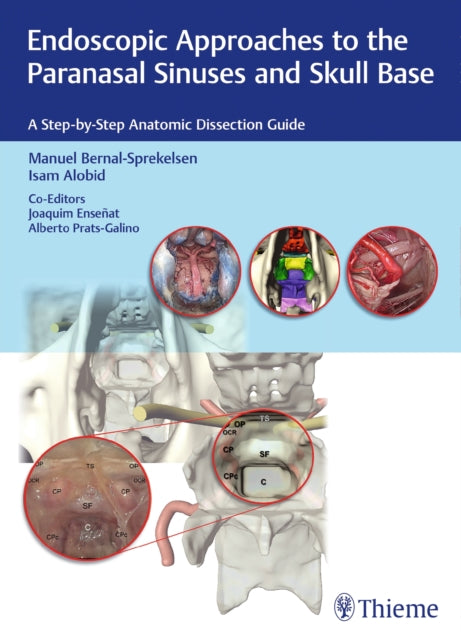 Endoscopic Approaches To The Paranasal S