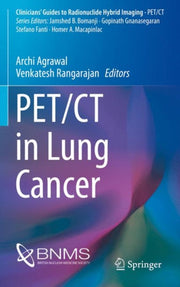 Pet Ct In Lung Cancer