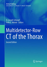 Multidetectorrow Ct Of The Thorax