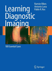 Learning Diagnostic Imaging : 100 Essent