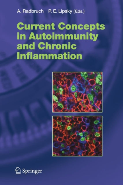 Current Concepts In Autoimmunity And Chr