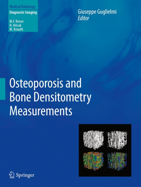Osteoporosis & Bone Densitometry Measure