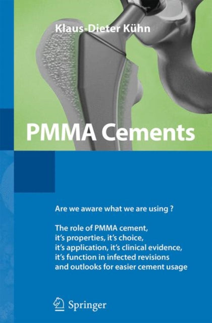 Pmma Cements By K Hn, Klaus-dieter