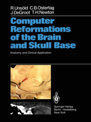 Computer Reformations Of The Brain And S