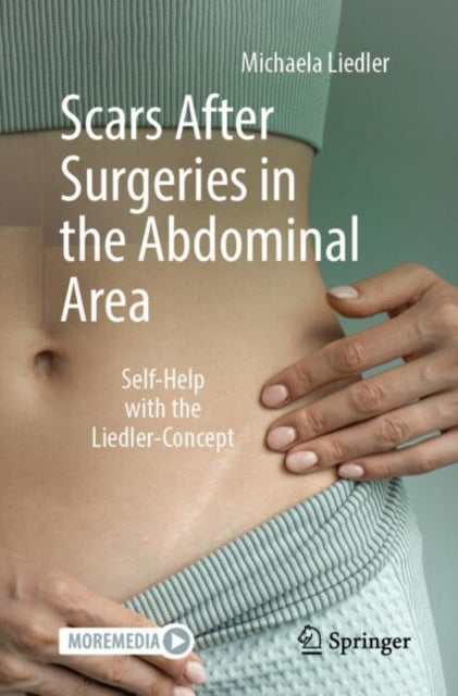 Scars After Surgeries In The Abdominal A