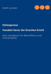Osteoporose:handeln Bevor Der Knochen Br