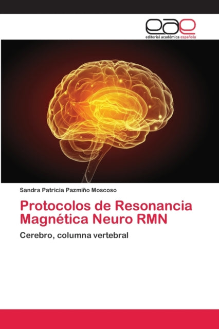 Protocolos De Resonancia Magn Tica Neuro