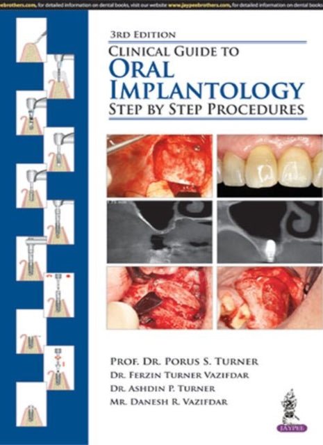 Clinical Guide Oral Implantology Sbs Pp By Turner Ashdin P