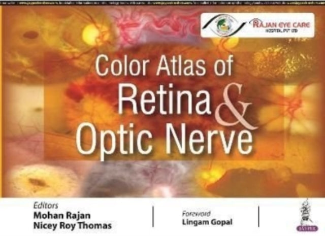 Color Atlas Of Retina Optic Nerve