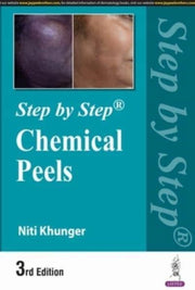 Step By Step Chemical Peels