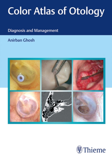 Color Atlas Of Otology