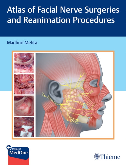 Atlas Of Facial Nerve Surgeries And Rea