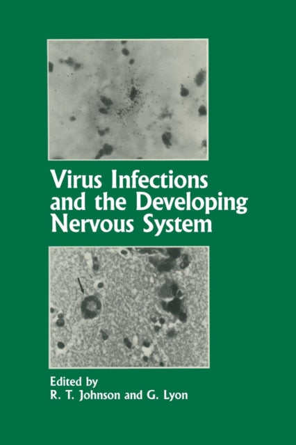 Virus Infections And The Developing Nerv