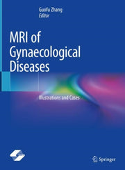 Mri Of Gynaecological Diseases By Zhang, Guofu