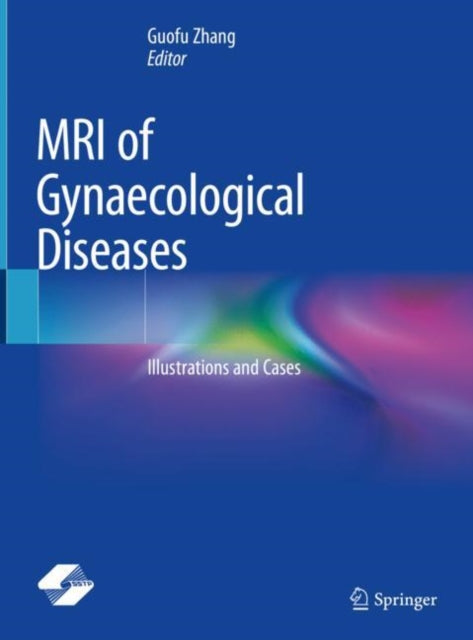 Mri Of Gynaecological Diseases By Zhang, Guofu