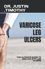 Varicose Leg Ulcers: The Ultimate Guide